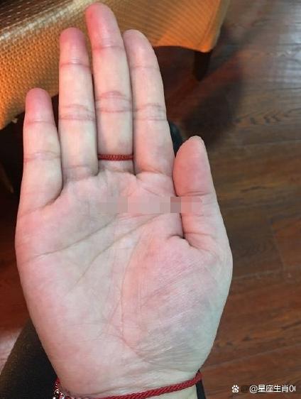 山根高,有主见,意志力强,会找事业有成的男人,婚后生活较稳定