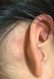 大耳朵的人一生大富大貴,長耳朵的高壽,你屬於哪種呢?