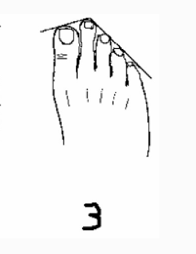 大拇指最長的人一生富貴，第三隻腳趾最長的是富二代，來看看你的那隻腳趾最長？