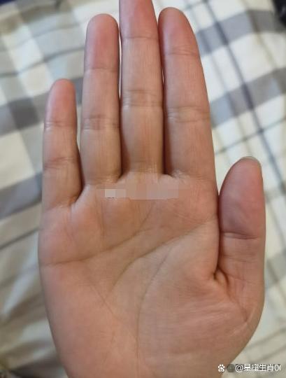 思维跳度大，处事犹豫不决，缺乏主见性，在感情上困扰