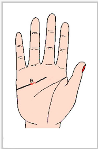 感情線上的「圈圈」稱「島紋」，注意，島紋是凶兆！