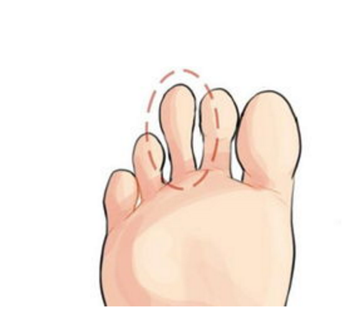 大拇指最長的人一生富貴，第三隻腳趾最長的是富二代，來看看你的那隻腳趾最長？