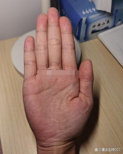 思维跳度大，处事犹豫不决，缺乏主见性，在感情上困扰