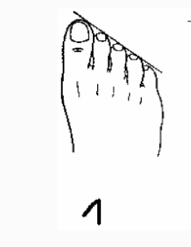 大拇指最長的人一生富貴，第三隻腳趾最長的是富二代，來看看你的那隻腳趾最長？