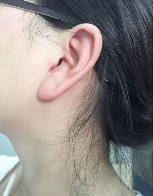 大耳朵的人一生大富大貴,長耳朵的高壽,你屬於哪種呢?