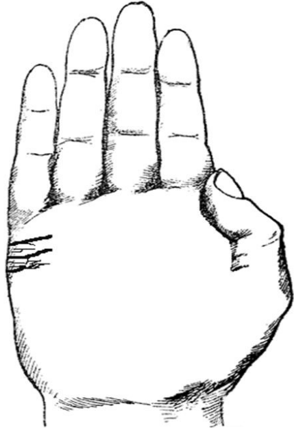 小心!這幾種婚姻線,預示著婚姻危機