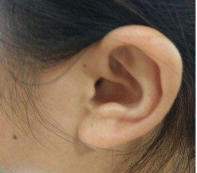 大耳朵的人一生大富大貴,長耳朵的高壽,你屬於哪種呢?