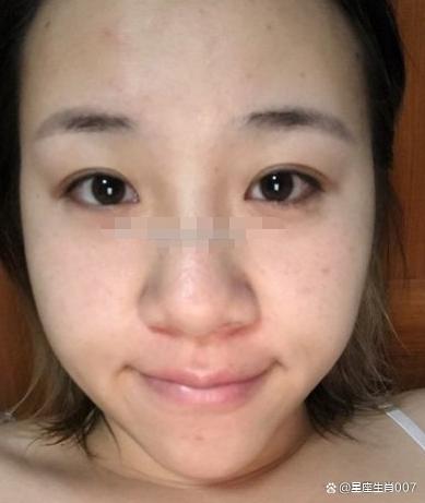 山根高,有主见,意志力强,会找事业有成的男人,婚后生活较稳定