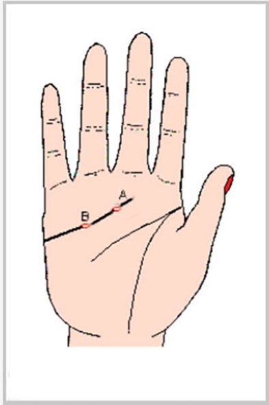 感情線上的「圈圈」稱「島紋」，注意，島紋是凶兆！