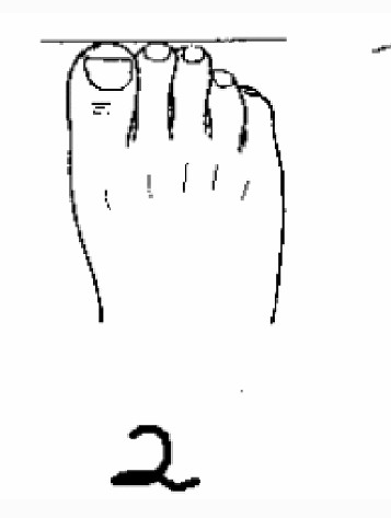 大拇指最長的人一生富貴，第三隻腳趾最長的是富二代，來看看你的那隻腳趾最長？