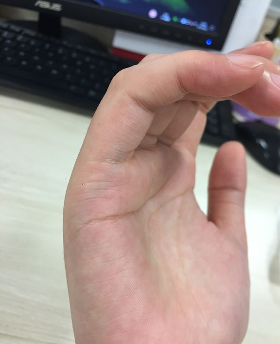 算命手相不求人准斷婚姻點（十）：婚姻線裂痕婚姻因此而斷裂