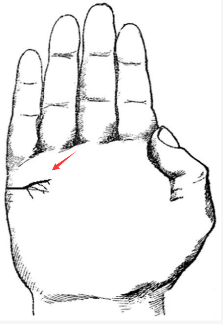 小心!這幾種婚姻線,預示著婚姻危機