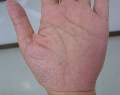 看過來，右手這個手指和無名指長度相等的，可能是同xing戀哦！