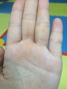 手發黃是什麼原因男性,手發黃是什麼原因?