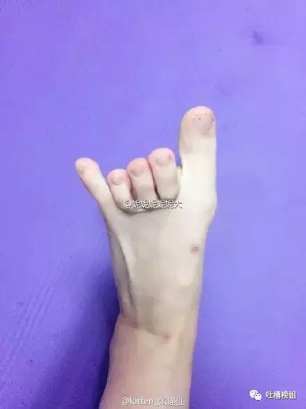 腳指頭伸不直是什麼命,從腳看是什麼命