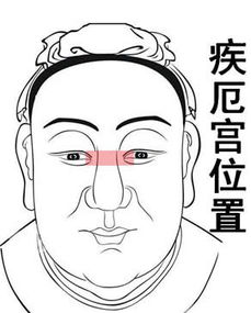 鼻樑發青迷信說法,鼻樑發青是怎麼回事
