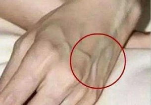 本命夢見自己手上爆血管,做夢夢見自己一直在干農活,手上都是刺