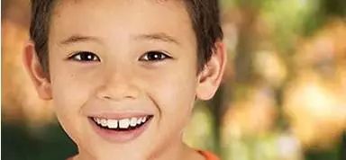 臉小牙大是什麼命女,女人牙齒代表什麼性格