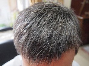 白頭髮多吃什麼,白頭髮多吃什麼好?