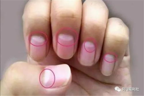 指甲上的月牙代表什麼,指甲上的月牙代表什麼?