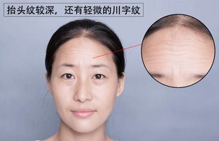 女人額頭中間一條豎紋,額頭正中有一道深深的豎紋,請問代表什麼?