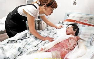 本命被燙傷是吉兆么,都說本命年不好,我好像是12歲本命年那年把腿燙傷一大片,很嚴重