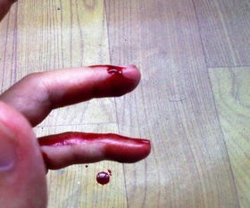 本命夢到被蛇咬到胳膊出血,夢見被蛇咬到手出血.