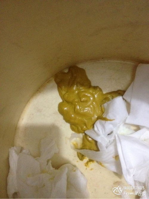 懷孕拉不出來屎怎麼辦,懷孕期間拉不出屎怎麼辦