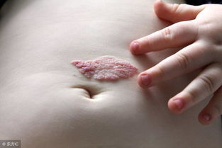 我身上胎記是個鳥是什麼命,胎記算命對運勢有何影響