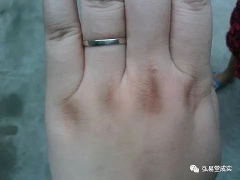 女人手背四個窩旺夫！