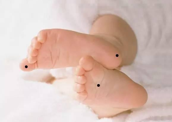 典型的富貴痣相就在這三個地方！