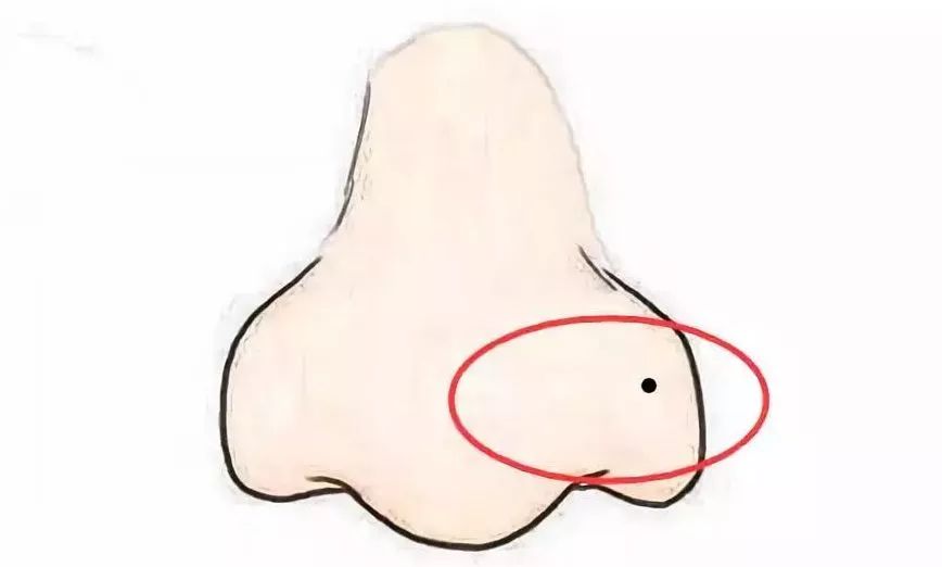 每天學風水:這里長痣存不住錢？