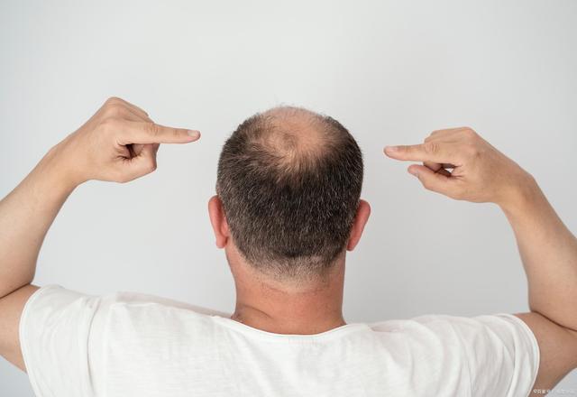 這4個部位藏痣的人為什麼會賺錢?答案找到了!