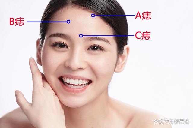 有“痣者”事竟成？盤點女生臉上那些美人痣，最後一種讓人羨慕！