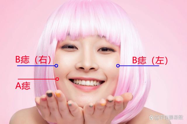 有“痣者”事竟成？盤點女生臉上那些美人痣，最後一種讓人羨慕！