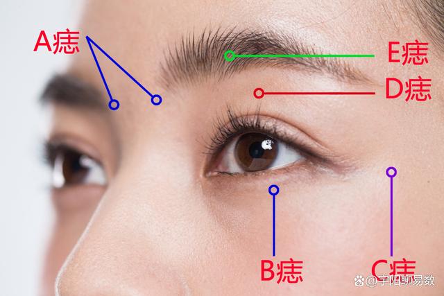 有“痣者”事竟成？盤點女生臉上那些美人痣，最後一種讓人羨慕！