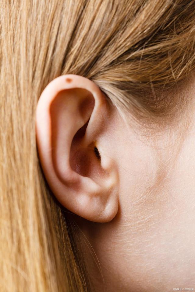 這4個部位藏痣的人為什麼會賺錢?答案找到了!